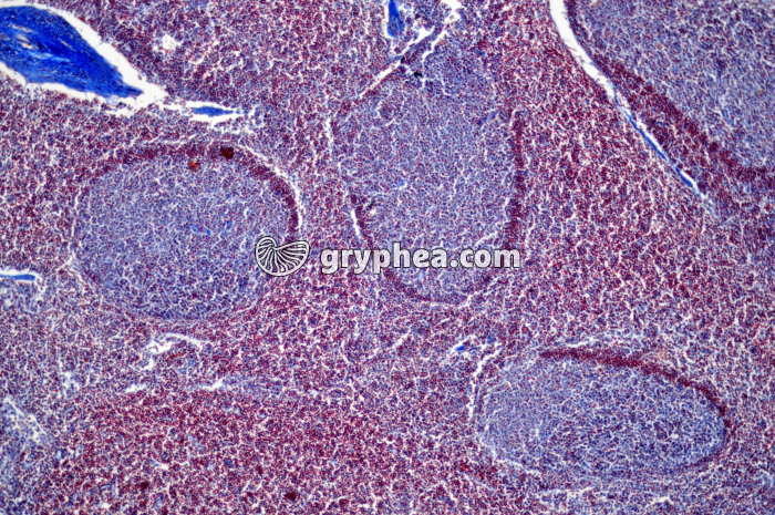 Ganglion lymphatique x25 - gryphea.com